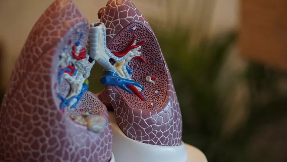 Pesquisadores descobrem novo tipo de célula nos pulmões humanos